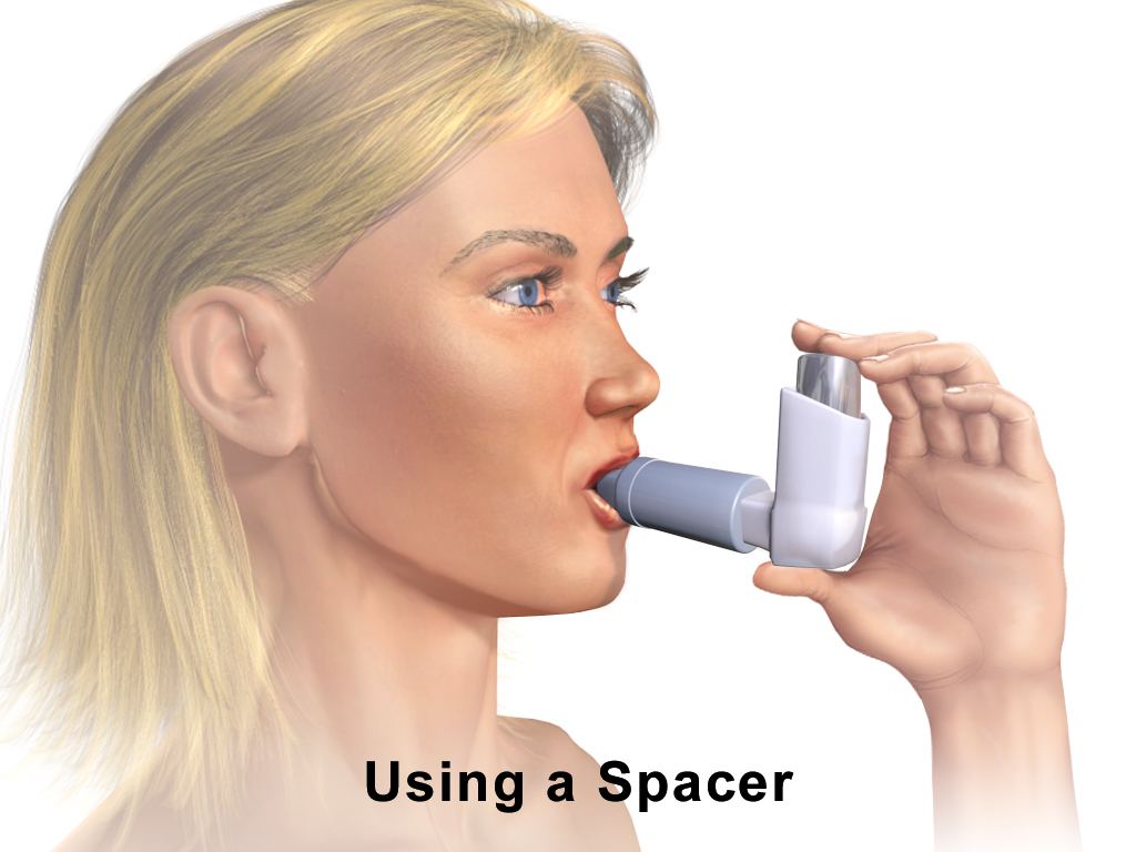 Medical illustration of an adult inhaling from a metered-dose inhaler attached to a spacer